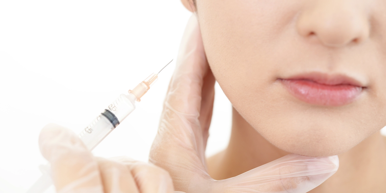 ボトックスについて